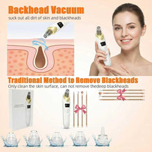 Electric Blackhead Remover