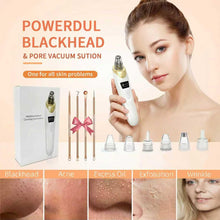 Electric Blackhead Remover