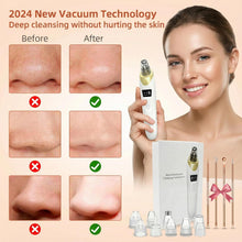 Electric Blackhead Remover